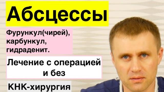 Абсцессы (фурункулы, карбункулы и др. гнойники) лечение. Абсцессы (фурункулы, карбункулы и др. гнойники) лечение.