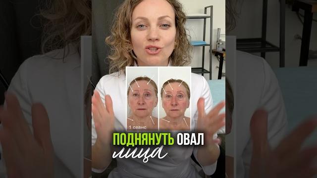 Делаем скульптурное лицо #подтянутьовал #отбрылей #убратьотеки #светагеба #убратьморщины Делаем скульптурное лицо #подтянутьовал #отбрылей #убратьотеки #светагеба #убратьморщины