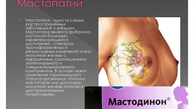 мастодинон мастодинон