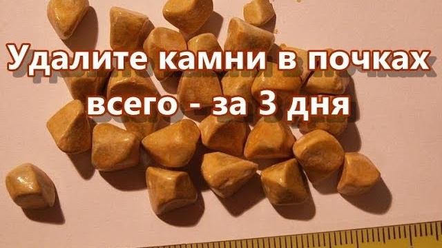 Удалите камни в почках всего за 3 дня Удалите камни в почках всего за 3 дня
