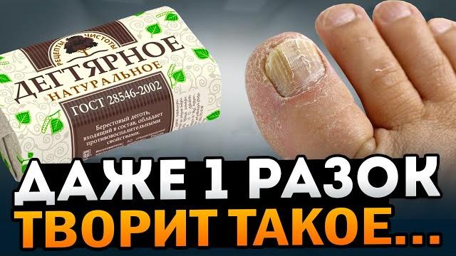 Больше не будешь использовать Дегтярное Мыло! Даже один РАЗОК вызывает НЕОБРАТИМЫЕ ПРОЦЕССЫ Больше не будешь использовать Дегтярное Мыло! Даже один РАЗОК вызывает НЕОБРАТИМЫЕ ПРОЦЕССЫ