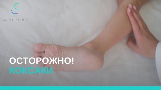 Вирус Коксаки Вирус Коксаки