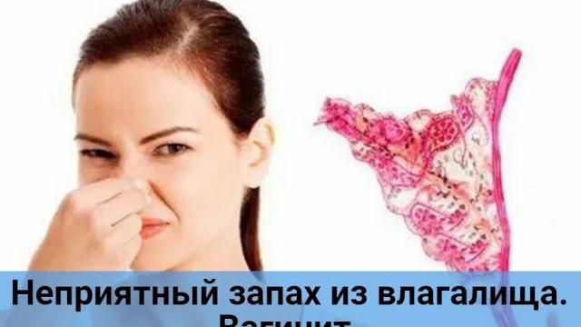 Неприятный запах из влагалища. Вагинит. Неприятный запах из влагалища. Вагинит.