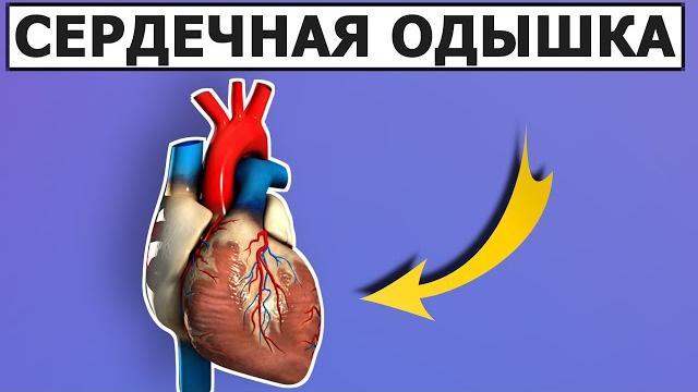 Избавьтесь от этих причин и сердечная одышка пройдет Избавьтесь от этих причин и сердечная одышка пройдет