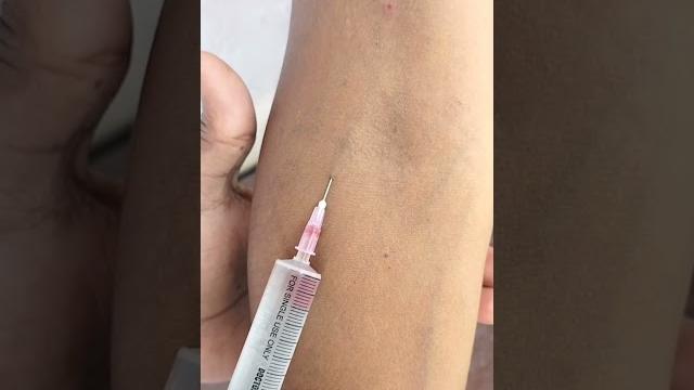 Pantop iv injection | intravenous injection | #viralshorts #trendingshorts #shorts #injection Pantop iv injection | intravenous injection | #viralshorts #trendingshorts #shorts #injection
