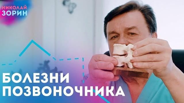 Что такое деформирующий спондилез, остеохондроз, спондилоартроз, фасеточный синдром, грыжа Шморля Что такое деформирующий спондилез, остеохондроз, спондилоартроз, фасеточный синдром, грыжа Шморля