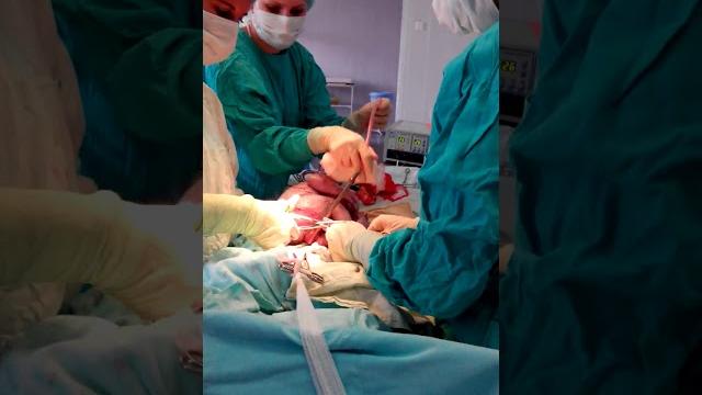 РОДЫ КЕСАРЕВО СЕЧЕНИЕ ПЕРВЫЙ КРИК НОВОРОЖДЕННОГО РОДЫ КЕСАРЕВО СЕЧЕНИЕ ПЕРВЫЙ КРИК НОВОРОЖДЕННОГО