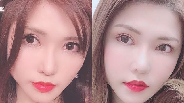 Anri Okita before and after her plastic surgery Anri Okita before and after her plastic surgery