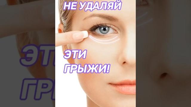 Как убрать мешки под глазами? Как убрать мешки под глазами?