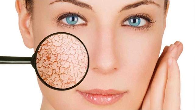 Почему шелушится кожа на лице? Почему шелушится кожа на лице?