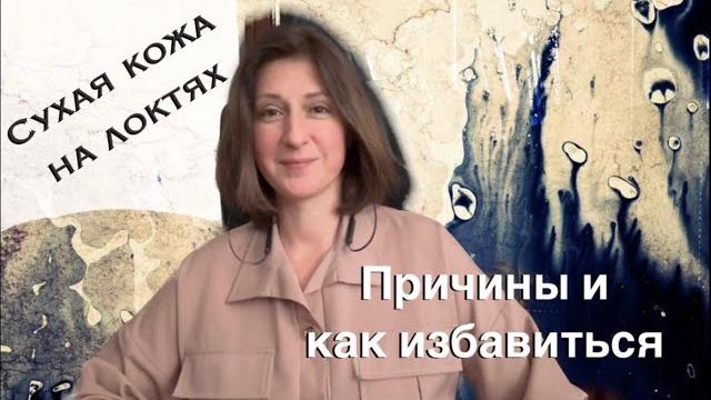 Очень СУХИЕ ЛОКТИ: причины и чем лечить Очень СУХИЕ ЛОКТИ: причины и чем лечить