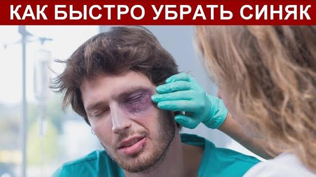 СИНЯК ПОД ГЛАЗОМ, КАК БЫСТРО УБРАТЬ В ДОМАШНИХ УСЛОВИЯХ СИНЯК ПОД ГЛАЗОМ, КАК БЫСТРО УБРАТЬ В ДОМАШНИХ УСЛОВИЯХ