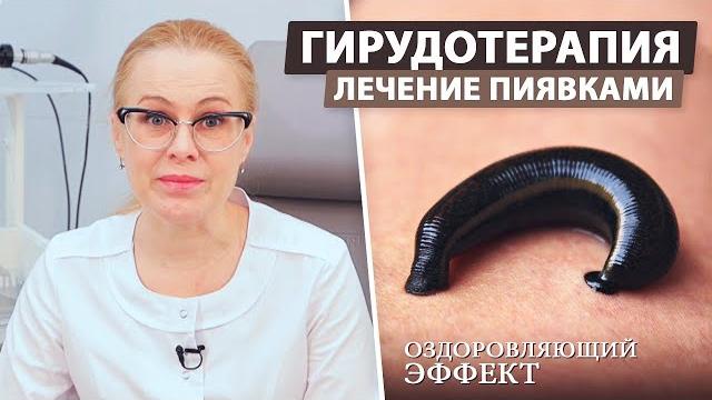 Лечение медицинскими пиявками (Гирудотерапия) Лечение медицинскими пиявками (Гирудотерапия)