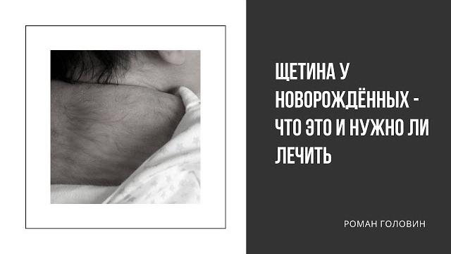 Щетина у новорождённых - Что это и нужно ли лечить Щетина у новорождённых - Что это и нужно ли лечить