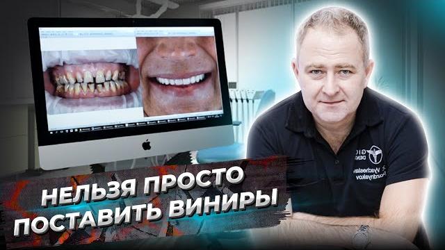 НЕЛЬЗЯ просто поставить ВИНИРЫ. ЧТО НУЖНО сделать перед установкой виниров. Установка виниров (16+) НЕЛЬЗЯ просто поставить ВИНИРЫ. ЧТО НУЖНО сделать перед установкой виниров. Установка виниров (16+)