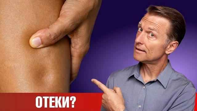 Отеки ног? 8 причин, почему у вас отекают ноги Отеки ног? 8 причин, почему у вас отекают ноги