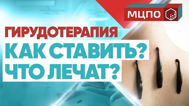 Гирудотерапия | Лечение пиявками. Как ставить пиявки? Гирудотерапия | Лечение пиявками. Как ставить пиявки?