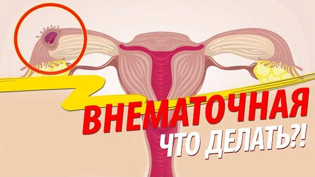 Внематочная беременность: что делать? Внематочная беременность: что делать?