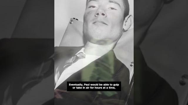 Man who spent 70 years in iron lung has died Man who spent 70 years in iron lung has died