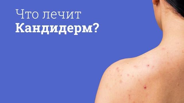 Кандидерм: инструкция по применению Кандидерм: инструкция по применению