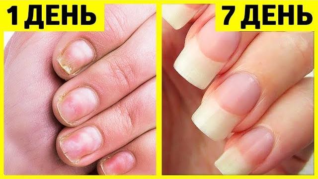 КАК ОТРАСТИТЬ КРЕПКИЕ НОГТИ ВСЕГО ЗА 7 ДНЕЙ КАК ОТРАСТИТЬ КРЕПКИЕ НОГТИ ВСЕГО ЗА 7 ДНЕЙ