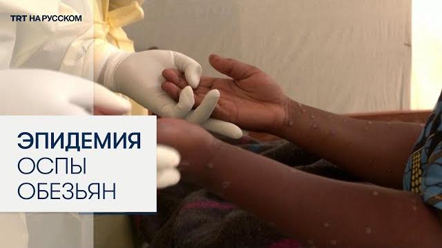 Осторожно — вспышка вируса оспы обезьян Осторожно — вспышка вируса оспы обезьян