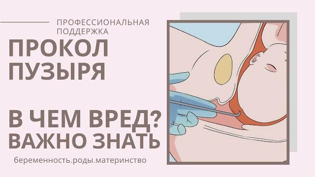 Прокол ПУЗЫРЯ в РОДАХ/АМНИОТОМИЯ/Околоплодный пузырь Прокол ПУЗЫРЯ в РОДАХ/АМНИОТОМИЯ/Околоплодный пузырь