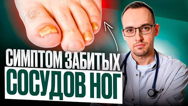 5 ПРИЗНАКОВ ЗАБИТЫХ СОСУДОВ НОГ. Как проверить дома без врача? 5 ПРИЗНАКОВ ЗАБИТЫХ СОСУДОВ НОГ. Как проверить дома без врача?