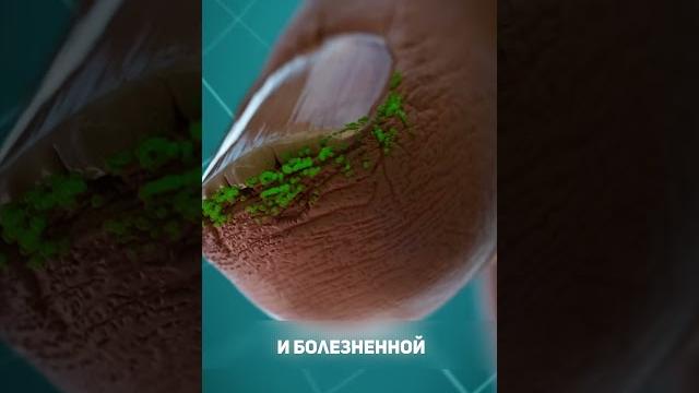 Почему не стоит грызть ногти Почему не стоит грызть ногти