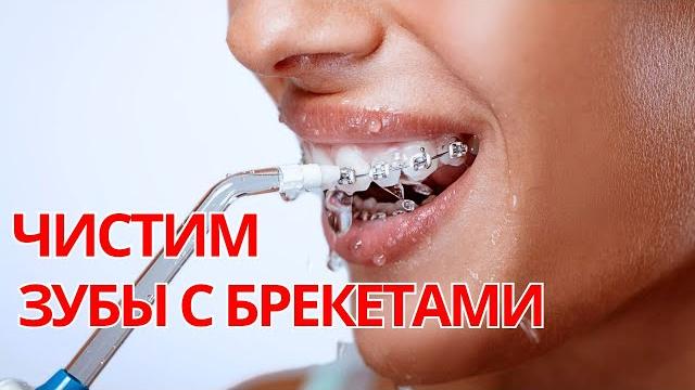 Полный алгоритм чистки зубов с брекетами: 6 шагов. Полный алгоритм чистки зубов с брекетами: 6 шагов.