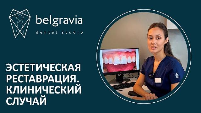 Эстетическая реставрация зубов. Клинический случай Эстетическая реставрация зубов. Клинический случай