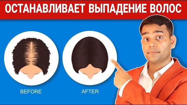 Остановите Выпадение Волос | ВЫПАДЕНИЕ ВОЛОС, АЛОПЕЦИЯ И ОБЛЫСЕНИЕ - Доктор Вивек Джоши Остановите Выпадение Волос | ВЫПАДЕНИЕ ВОЛОС, АЛОПЕЦИЯ И ОБЛЫСЕНИЕ - Доктор Вивек Джоши