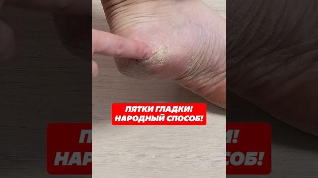 Пятки гладки! Народный способ! #пятки #педикюр #уходзакожей #трещинынапятках #грубаякожа #кожа Пятки гладки! Народный способ! #пятки #педикюр #уходзакожей #трещинынапятках #грубаякожа #кожа