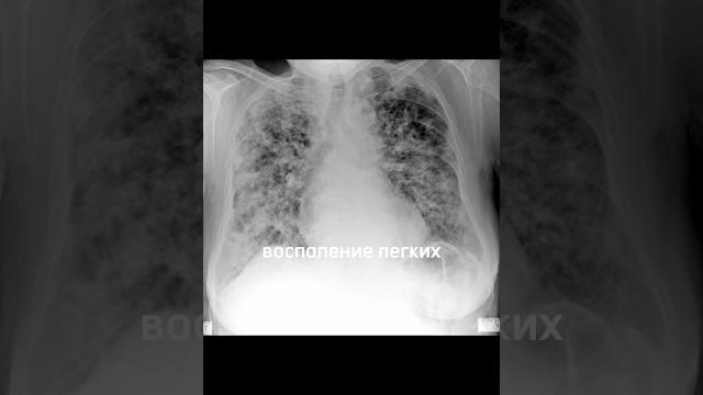 От чего погибли известные люди#57 #Есенин От чего погибли известные люди#57 #Есенин