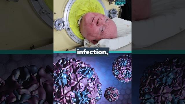Paul Alexander contracted polio aged six and spent more than 70 years in an iron lung #itvnews Paul Alexander contracted polio aged six and spent more than 70 years in an iron lung #itvnews