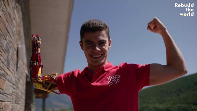 How I built my Prosthetic Arm with LEGO Bricks How I built my Prosthetic Arm with LEGO Bricks