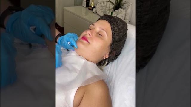 А на видео, делаем инъекции липолитиков для коррекции второго подбородка #косметологмосква А на видео, делаем инъекции липолитиков для коррекции второго подбородка #косметологмосква