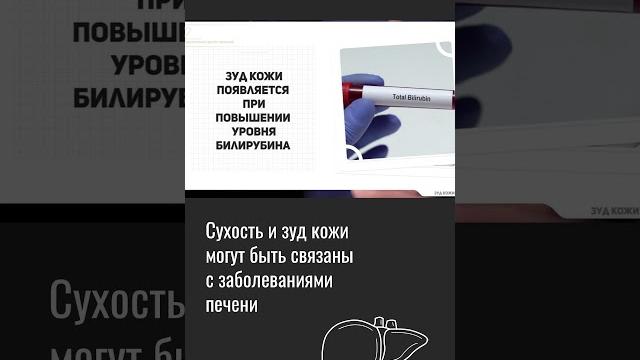 Как связаны печень, зуд и сухость Как связаны печень, зуд и сухость