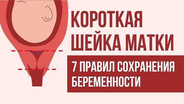 Истмико-цервикальная недостаточность или укороченная шейка матки при беременности. Что делать? Истмико-цервикальная недостаточность или укороченная шейка матки при беременности. Что делать?