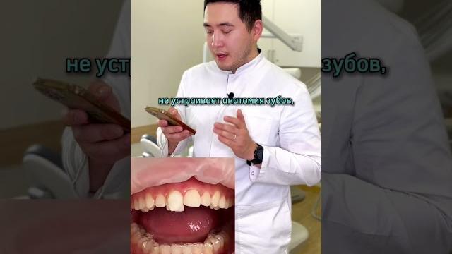 Как делают композитные виниры Как делают композитные виниры