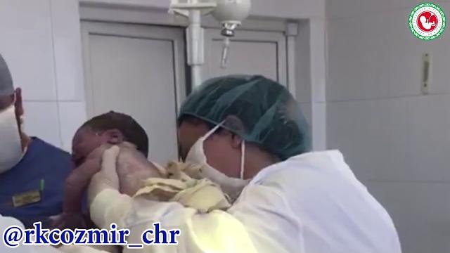 "Естественное кесарево" сечение "Естественное кесарево" сечение