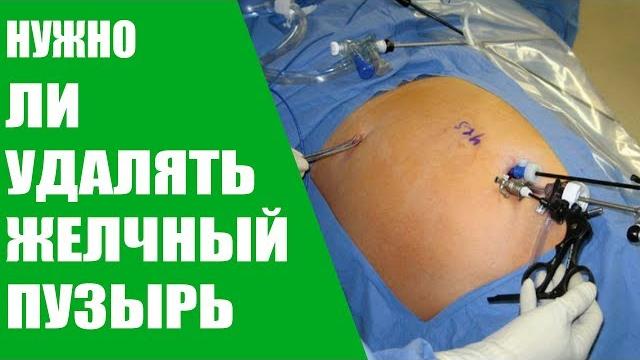 Нужно ли удалять желчный пузырь Нужно ли удалять желчный пузырь