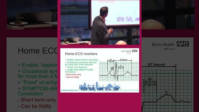 Accurate ECG Tracing Accurate ECG Tracing