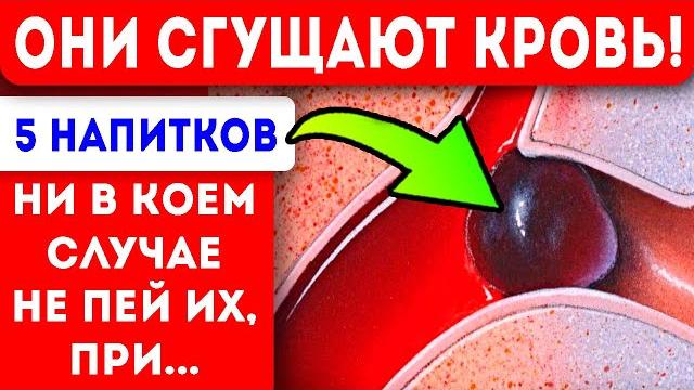 От них кровь густеет уже через 5 мин после попадания в желудок! Варикоз тромбы тромбофлебит и... От них кровь густеет уже через 5 мин после попадания в желудок! Варикоз тромбы тромбофлебит и...