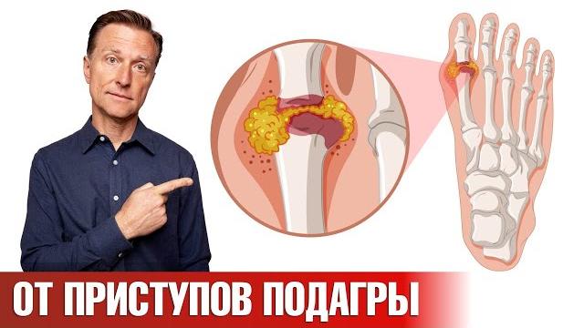 Средство №1 от приступов подагры, которое есть у каждого Средство №1 от приступов подагры, которое есть у каждого