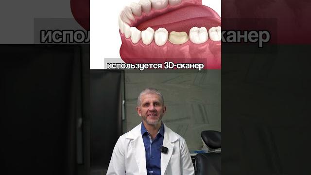 Вся правда о коронках на зубы простыми словами Вся правда о коронках на зубы простыми словами