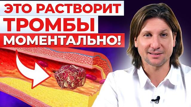 ЭТИ продукты разжижают ТРОМБЫ! Как спасти себя от тромбоза? ЭТИ продукты разжижают ТРОМБЫ! Как спасти себя от тромбоза?