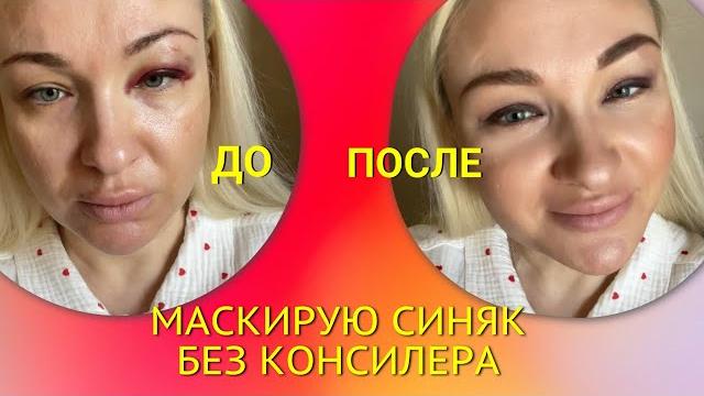 Как замаскировать синяк на глазу пудрой. ДО и ПОСЛЕ - офигеете! Макияж для всех Синяки под глазами. Как замаскировать синяк на глазу пудрой. ДО и ПОСЛЕ - офигеете! Макияж для всех Синяки под глазами.