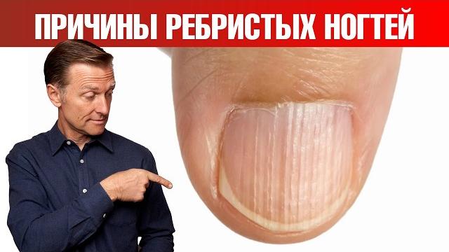 О чем кричат ваши ногти? Не лечите симптом, ищите ПРИЧИНУ О чем кричат ваши ногти? Не лечите симптом, ищите ПРИЧИНУ