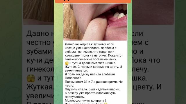 опухла десна, болит зуб, а к врачу идти нет денег опухла десна, болит зуб, а к врачу идти нет денег